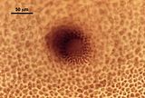 5 - Pericarpo ostiolato
